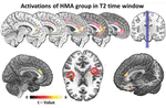 The impact of math anxiety on working memory: A cortical activations and cortical functional connectivity {EEG} study