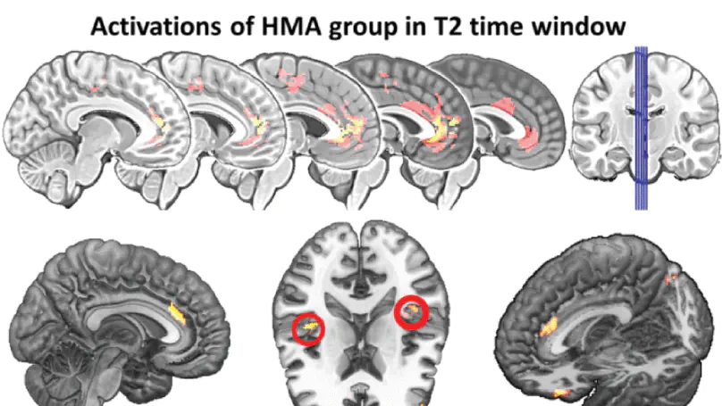 The impact of math anxiety on working memory: A cortical activations and cortical functional connectivity {EEG} study