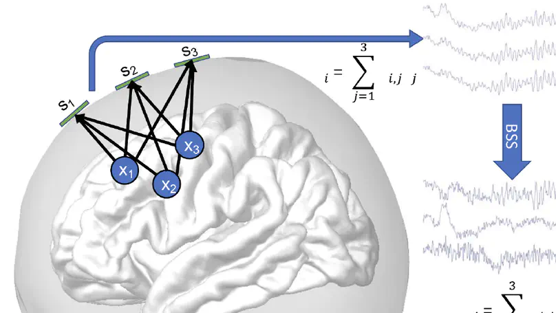 Which BSS method separates better the EEG Signals? A comparison of five different algorithms